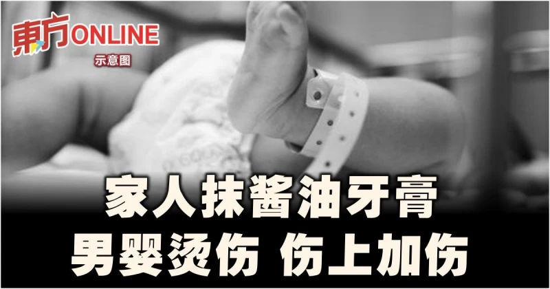 男嬰燙傷　家人抹醬油牙膏…傷上加傷