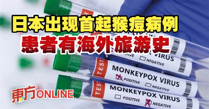 日本出現首起猴痘病例　患者有海外旅遊史