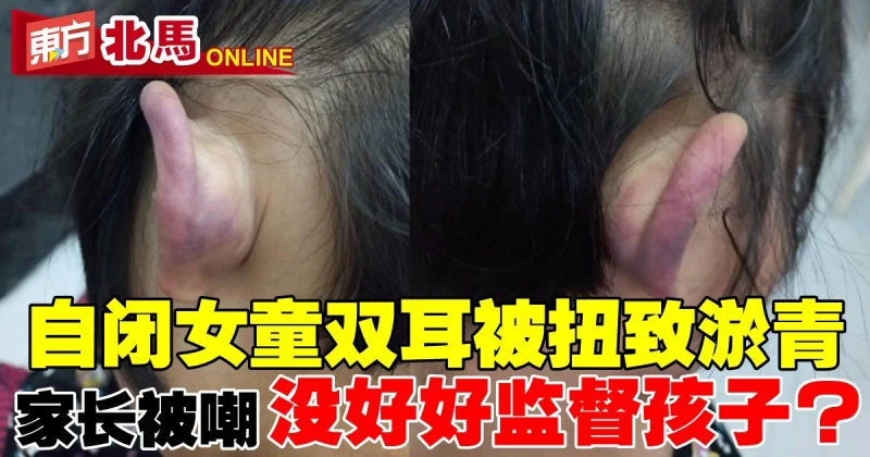 自閉女童被大力扭耳朵致淤青　家長還被嘲笑「沒好好監督孩子」