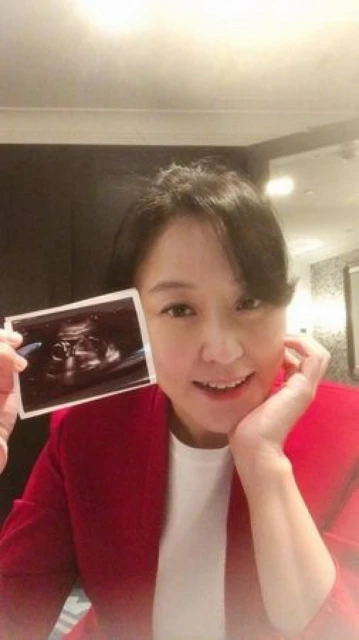45歲女藝人「手拿超音波照」驚喜宣布懷孕