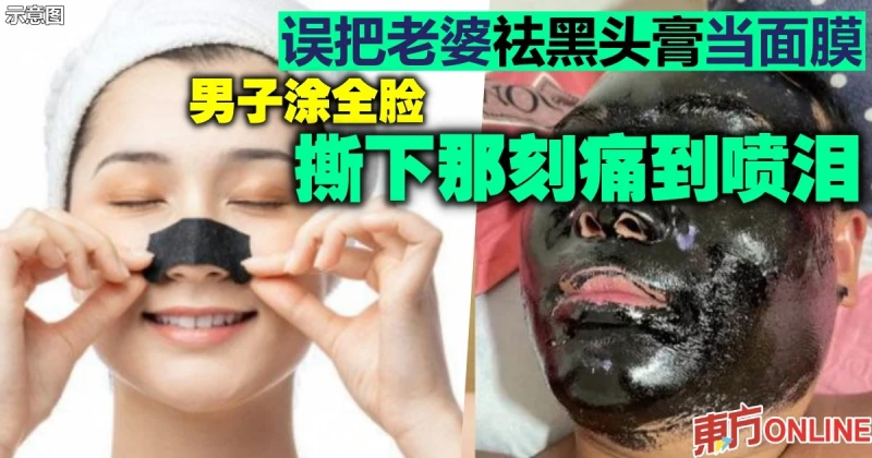 誤把老婆祛黑頭膏當面膜　男子塗全臉撕下那刻痛到噴淚