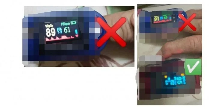 血氧儀要慎選莫貪便宜　消毒隊隊長：誤測結果很危險