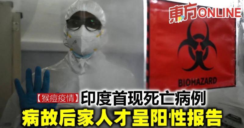 【猴痘疫情】印度首現死亡病例　病故後家人才呈陽性報告