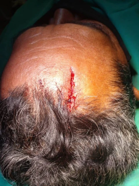 毒蟲不滿養父責罵   怒揮刀砍傷爸爸