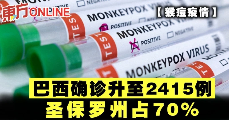 【猴痘疫情】巴西確診升至2415例　聖保羅州占70%