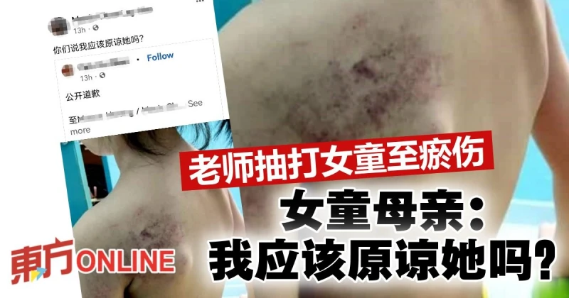 【老師抽打女童至瘀傷】女童母親：我應該原諒她嗎？