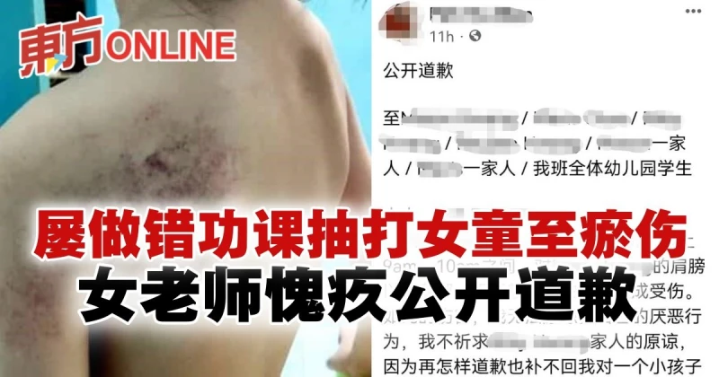 屢做錯功課抽打女童至瘀傷　女老師感愧疚社媒公開道歉