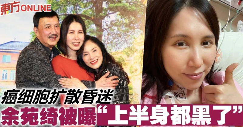 癌細胞擴散昏迷　余苑綺被曝「上半身都黑了」