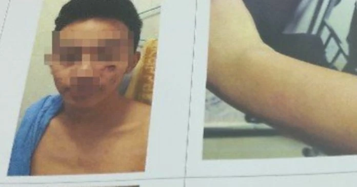 「豬仔」若求助的話更慘    大馬10男1女慘遭凌虐