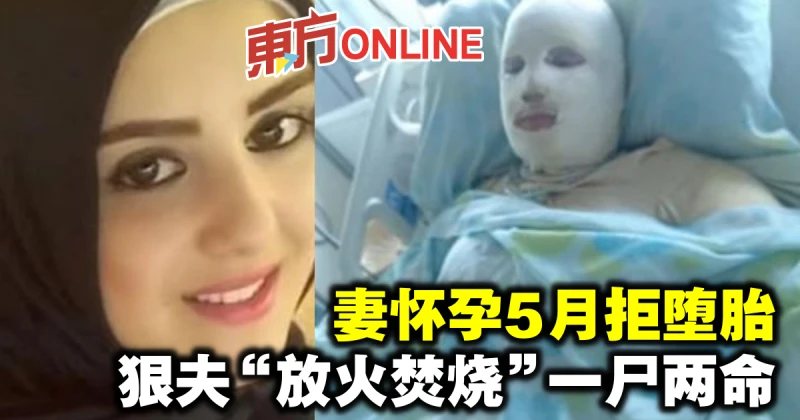 妻懷孕5月拒墮胎　狠夫「放火焚燒」 一屍兩命