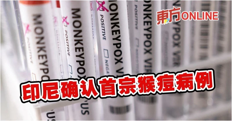 【猴痘疫情】印尼確認首宗感染病例