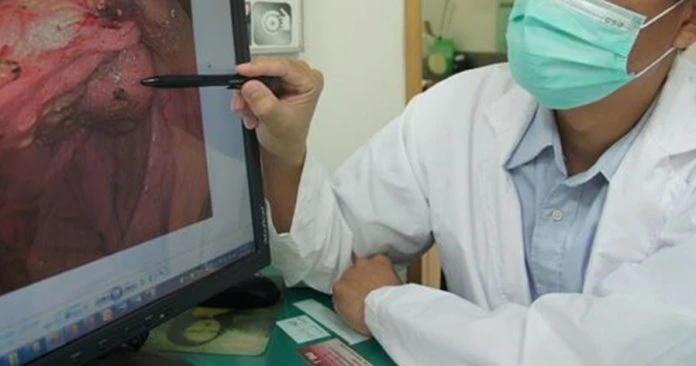 余苑綺腸癌病逝    當年大便有血以為是痔瘡