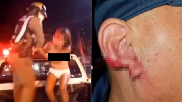 泰女芭堤雅當街發酒瘋 咬下遊客耳垂吞下肚