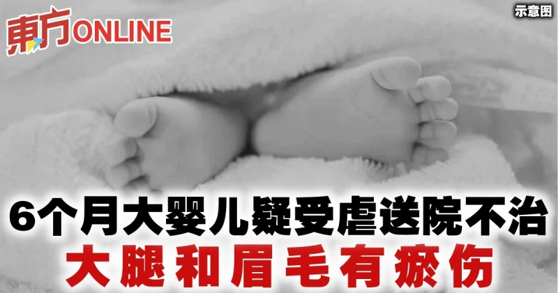 6個月大嬰兒疑受虐送院不治　大腿和眉毛有瘀傷