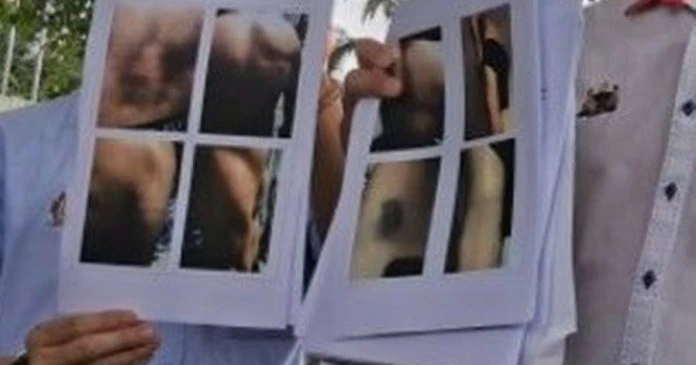 剃光頭關水牢「喝糞水維生」  大馬有豬仔被救出後成失智青年