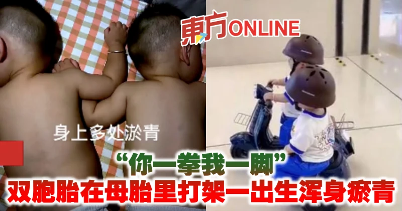 「你一拳我一腳」　雙胞胎在母胎里打架一出生渾身瘀青