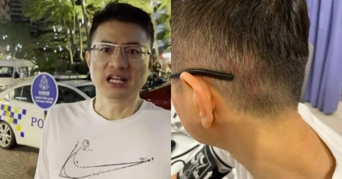 疑捲入桃色糾紛　「大馬王力宏」商場遭打傷後腦勺