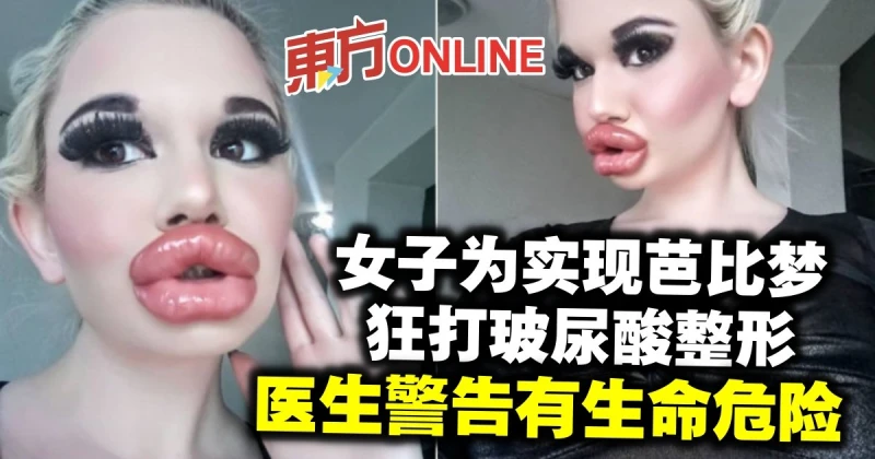 女子狂打30次玻尿酸腫成香腸嘴　醫生警告有生命危險