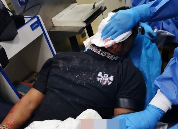 「翻版古天樂」黃竣鋒遇襲　古天樂送5萬應急：放心療傷，我會幫你