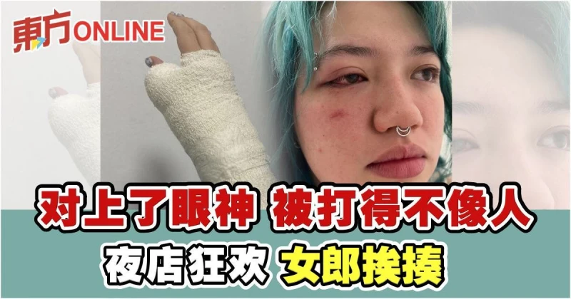 夜店狂歡疑捲入瞪眼風波　兩女郎遭暴打受傷入院