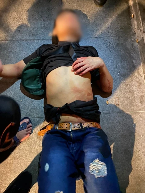 疑酒後衝突導致　外籍男子遭人刺傷腰部