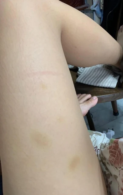 分手情侶互相指控　女稱被踢打…男指遭威脅