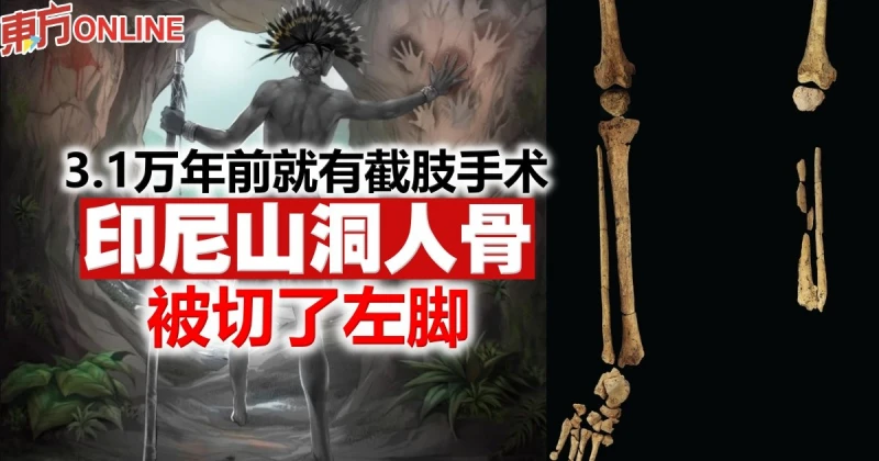3.1萬年前就有截肢手術　印尼山洞人骨被切了左腳