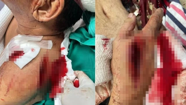 兩賊深夜入屋行竊 馬國阿叔反抗遭砍五刀皮開肉綻