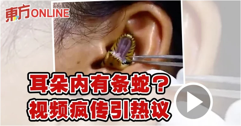 耳朵內有條蛇？　視頻瘋傳引熱議
