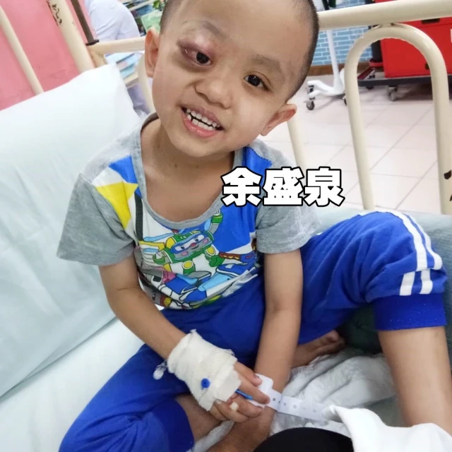 全馬首宗眼球腫大  6歲華裔男童需35萬治療