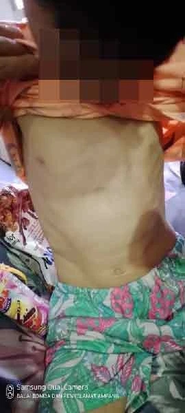 年幼兄妹疑遭禁錮虐待 哥哥爬窗出逃被救 警逮捕阿姨夫妻