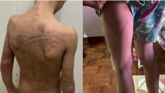 被虐待馬國男童爬窗撿束線帶 站窗沿邊被困呼救