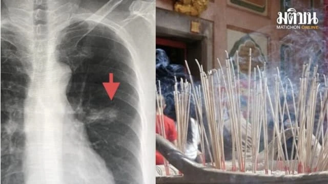 沒吸菸或吸入二手菸 泰婦連續六年燒香患肺癌