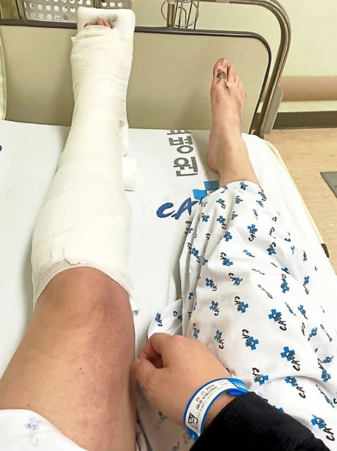 【梨泰院踩踏事故】1大馬女子夾斷腿 2友人不幸身亡