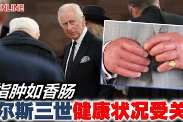 手指腫如香腸　查爾斯三世健康狀況受關注