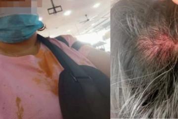 顧客嫌椰漿飯太貴拒付錢 惹怒新山小販打人兼亮刀