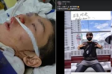 疑井蓋造成路面隱患 馬國少年車禍傷重逝世