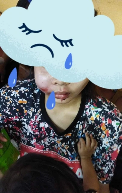 男子誤踩油門　靈鹿轎車沖入餐館撞傷6人