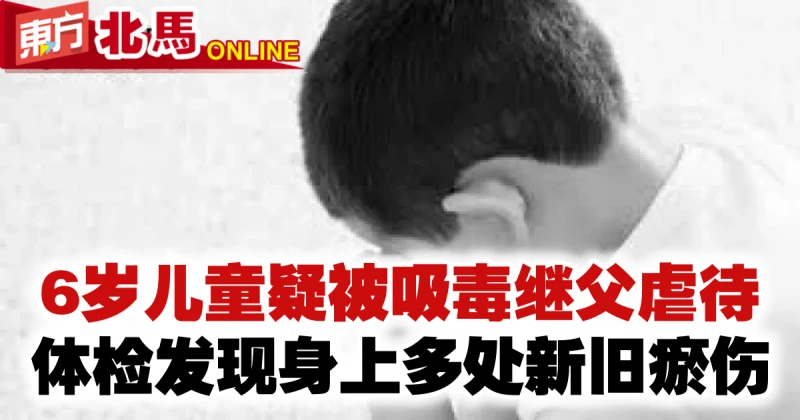 6歲童疑被吸毒繼父虐待　體檢發現身上多處新舊瘀傷