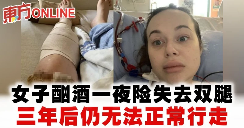 女子酗酒一夜險失去雙腿　3年後仍無法正常行走