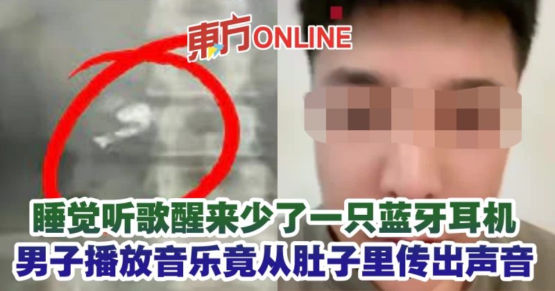 睡覺聽歌醒來少了一隻藍牙耳機　男子播音樂竟從肚裡傳出聲音