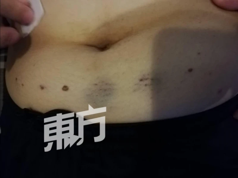 【抗癌勇士】積極面對癌症　廖芳寧半年治癒淋巴癌