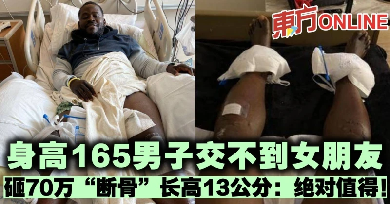 身高165男子交不到女朋友　砸70萬「斷骨」長高13公分：絕對值得！