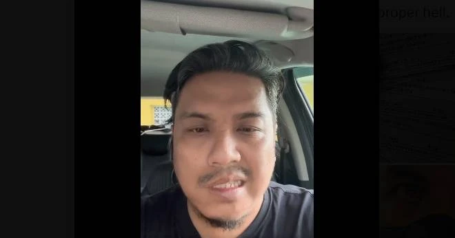 一覺醒來半邊臉癱瘓　男子分享患上貝爾氏面癱痛苦經歷