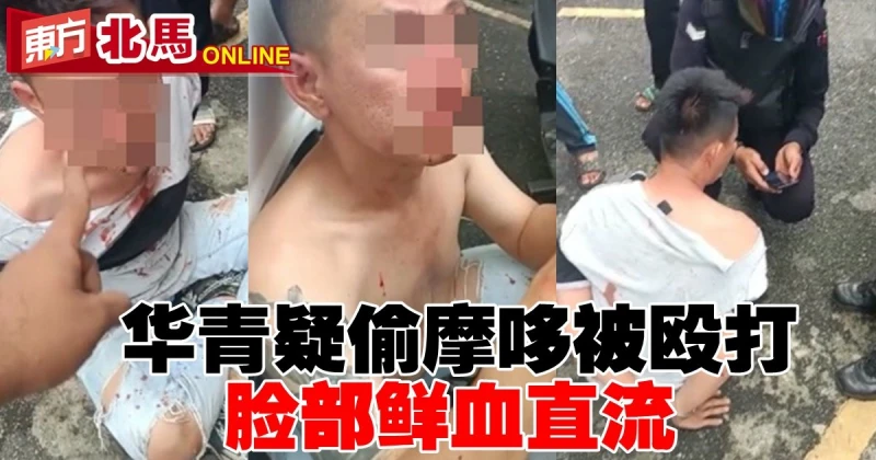 華青疑偷摩哆被毆打　臉部鮮血直流