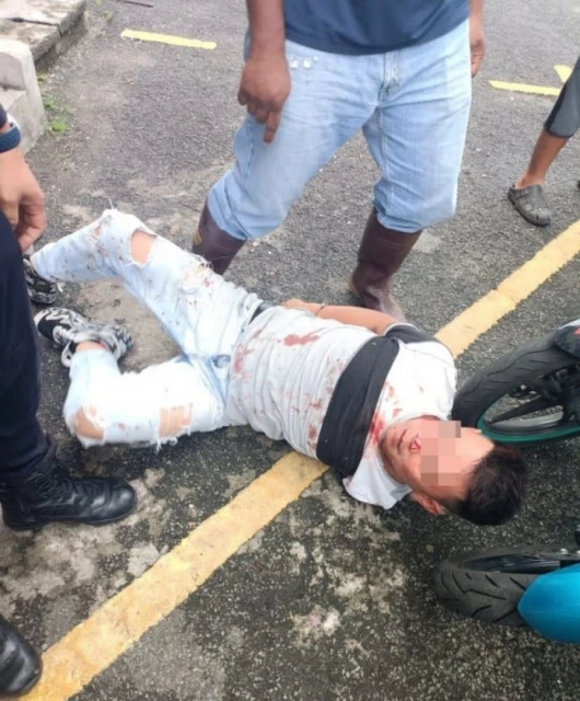 疑偷竊遭毆打　華裔青年臉部鮮血直流