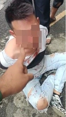 疑偷竊遭毆打　華裔青年臉部鮮血直流