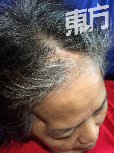 無情火燒毀貧困家庭唯一收入　一家四口愁上加愁