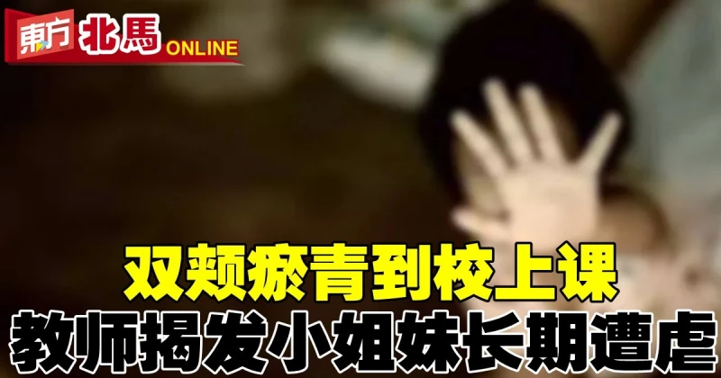 雙頰瘀青到校上課　教師揭小姐妹長期遭繼父虐打成傷
