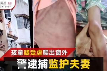 年幼兄妹疑遭禁錮虐待 哥哥爬窗出逃被救 警逮捕阿姨夫妻